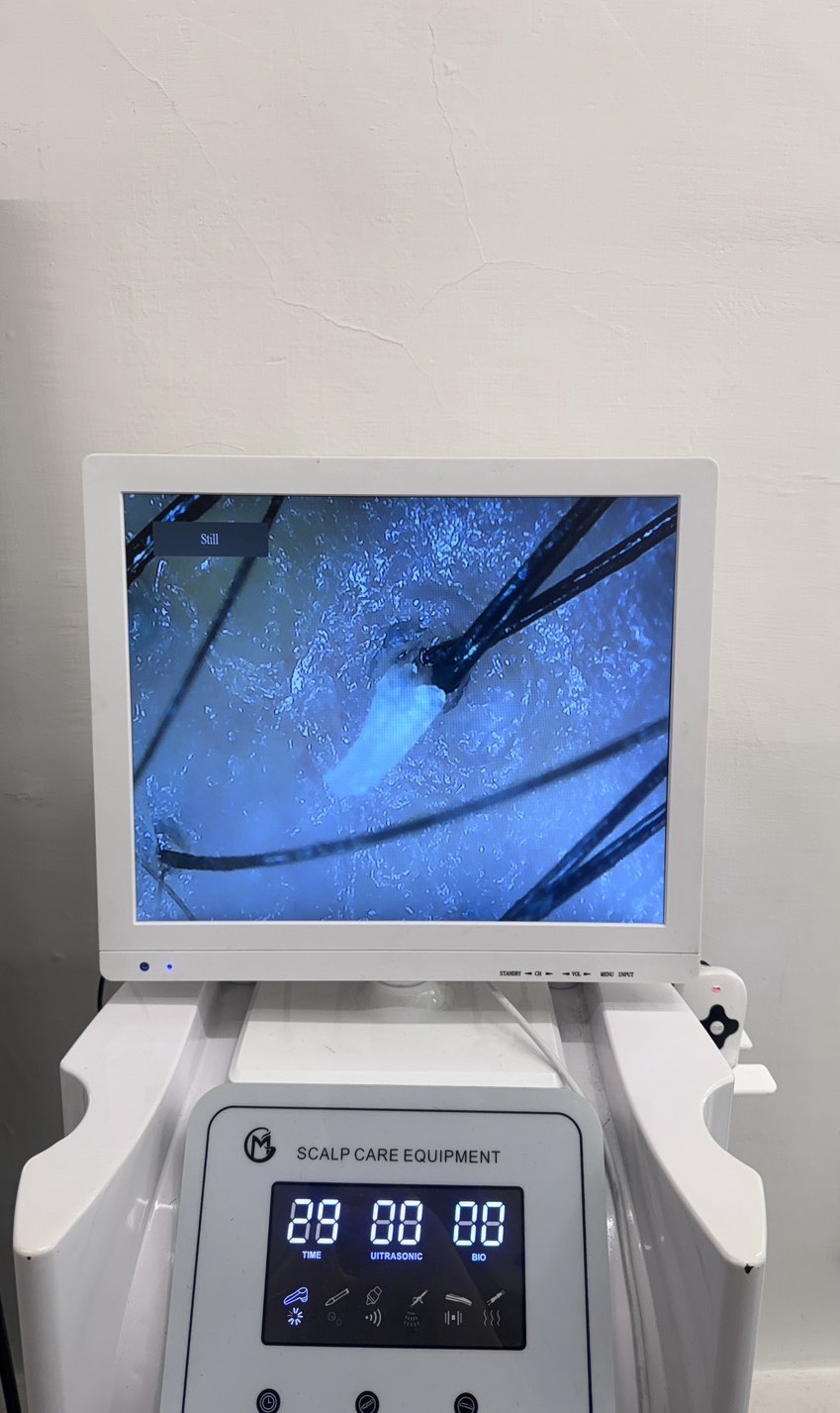 台南頭皮護理推薦！綠色模式美髮沙龍、頭皮養護-在地經營10年，頭皮天然植萃養護推薦