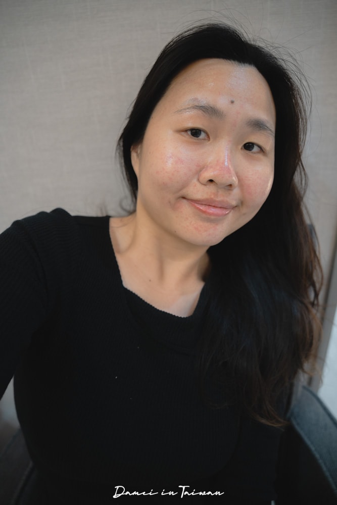 台北無針水光針推薦｜維昕時尚診所-推薦怕痛又愛美的你，肌膚光澤感超自然！